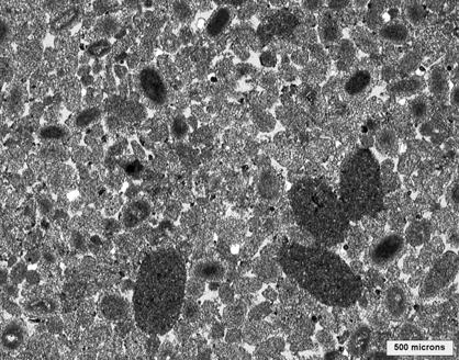 Patchy poikilotopic anhydrite replacement is observed (< 8%), and some euhedral dolomite crystals occupy the intergranular pores.