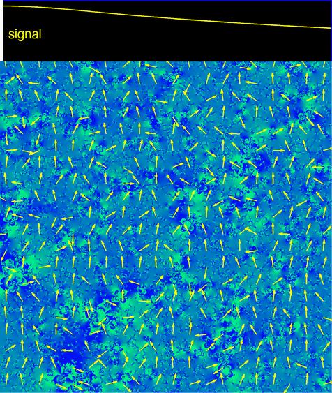 Source of signal dropout BOLD contrast is based on signal