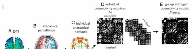 Structural Brain Networks The Human Brain Rich-Club Organization of the Human Connectome