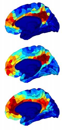Dynamic Brain Towards Networks a Large-Scale Model of the Human Brain Model Comparison with Human MRI Structural