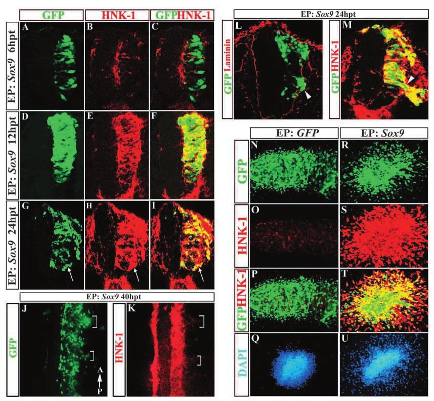 Sox9 and neural crest induction 5685 Fig. 2. Sox9 induces HNK-1 expression and neural crest differentiation.