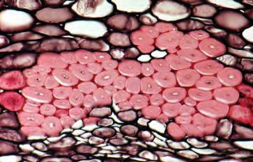The fleshy tissue of many fruits is composed mainly of parenchyma cells.