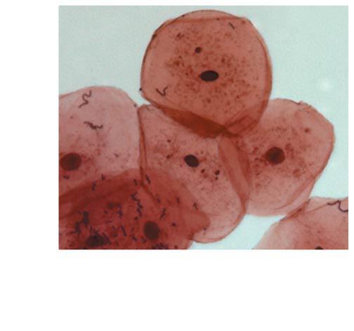 50 µm Staining increases