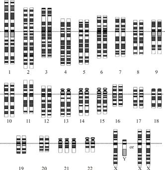 Unit 5: Heredity 1. How does meiosis affect the number of chromosomes? 2. Is this karyotype normal? If not, what disorder is displayed? 3.