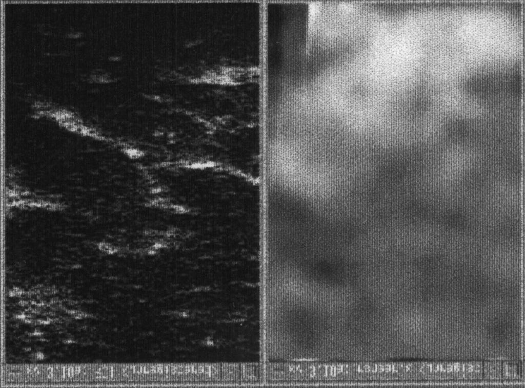 that of the visibly detected leaving. The dynamic range is 34.0 db, and the spatial resolution coagulation. However, though shear modulus value of the blood is 1.6 mm x 1.6 mm. The photograph (Fig.