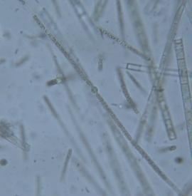Other Cyanobacteria Microcystis Sp.