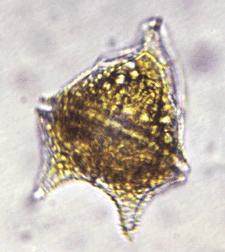 cladocerans copepods