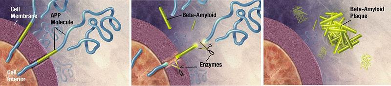 Amyloid Fibers involved in Alzheimers Protein amyloid fibers are often found to have a β-sheet structure regardless of their sequence, leading some to believe that it is the molecule's misfolding