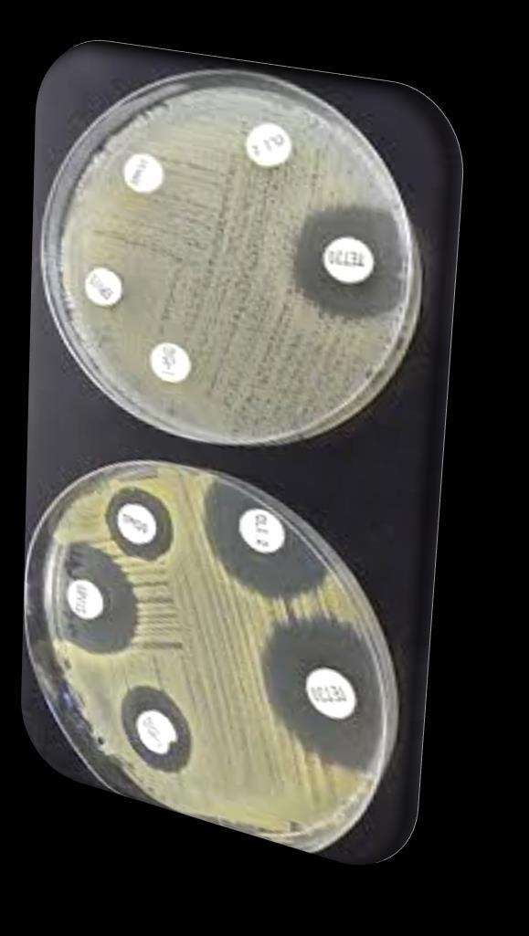 28 Agar Disk Diffusion CLSI: M100-S 19 The Most Resistance Doxycycline:( D