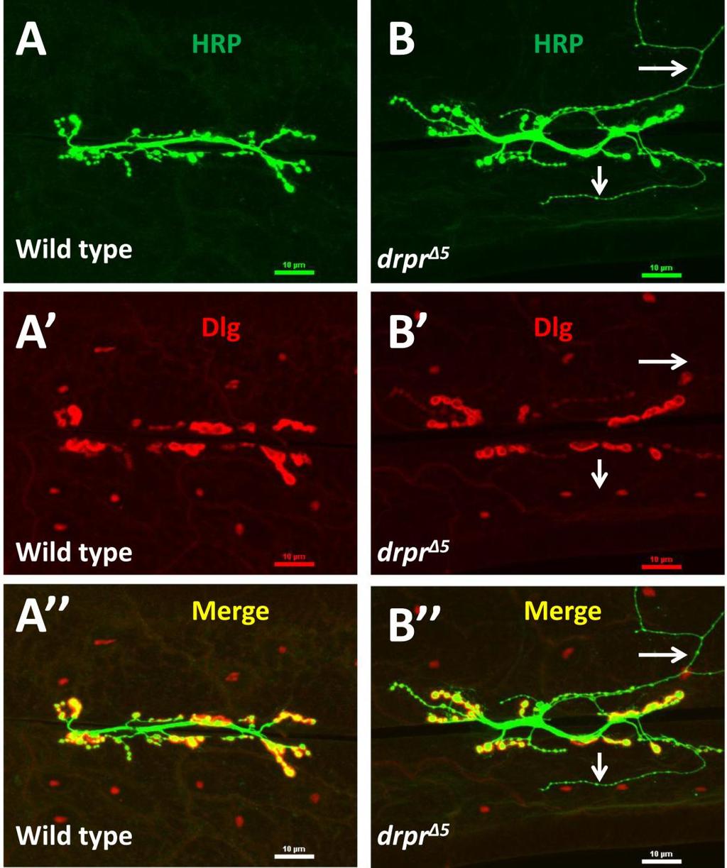 Figure 3.18 drpr null mutant NMJ exhibits long, small-caliber neuronal protrusions.