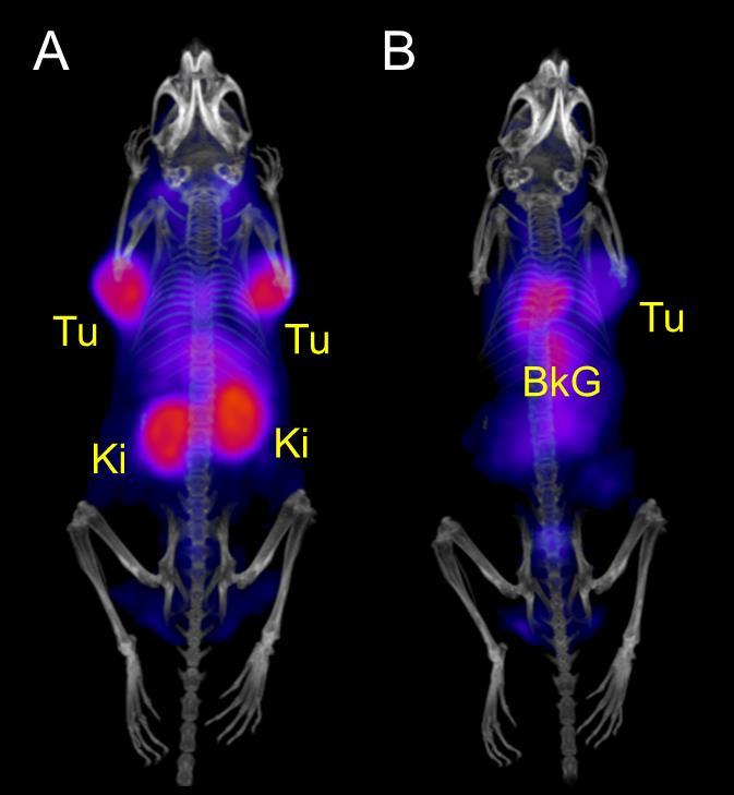 Fig. S4. PET/CT images of KB tumor-bearing mice 2 h after injection of 68 Ga-rf42 only (A) and 68 Garf42 after a pre-injection of folic acid (B) shown as maximal intensity projections.