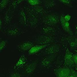 MitoTrcker Red nd green fluorescence indictes