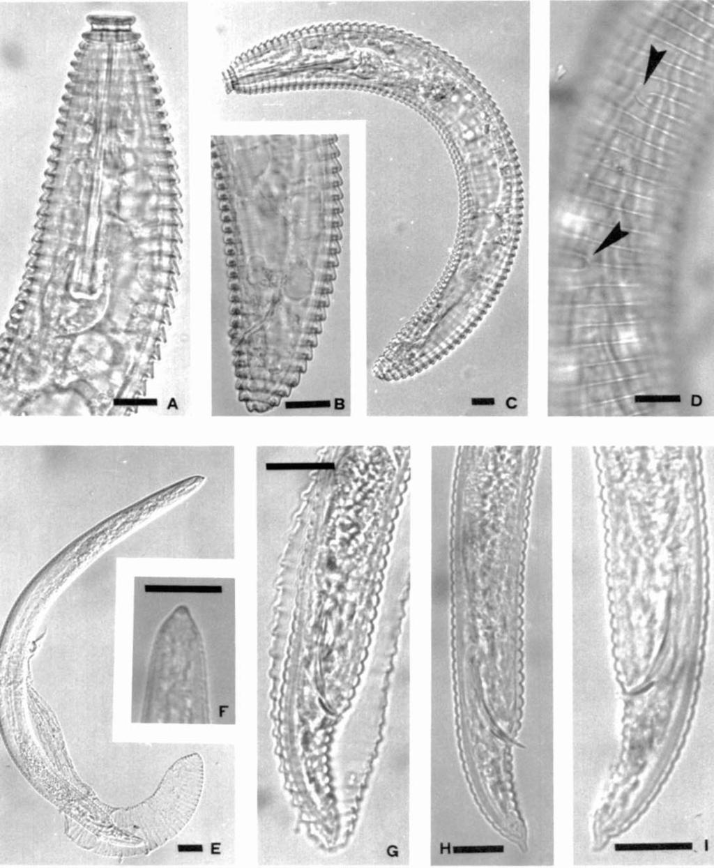 E-I) Male of D. degrissei. E) Enclosed in the juvenile cuticle. F) Anterior region. G-I) Posterior body region, longer styler length (61-71 vs. 35-47 um), and by the more posterior vulva (Rv = 6-8 vs.