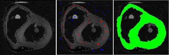 (left) The DT-MRI slice visualized using T (1, 1). (middle) Manually selected heart seed points (red) and background seed points (blue). (right) Cardiac segmentation result shown in green. 5.