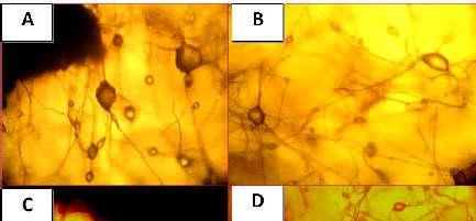 9(A- D): Spore proliferations and newly formed spores arise showing