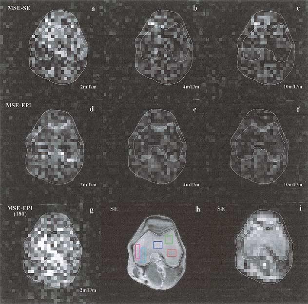 variability. Furthermore to make sure that the signal obtained with the imaging sequence described in Fig. 1 was unquestionably related to DQCs, the correlation gradient was varied.