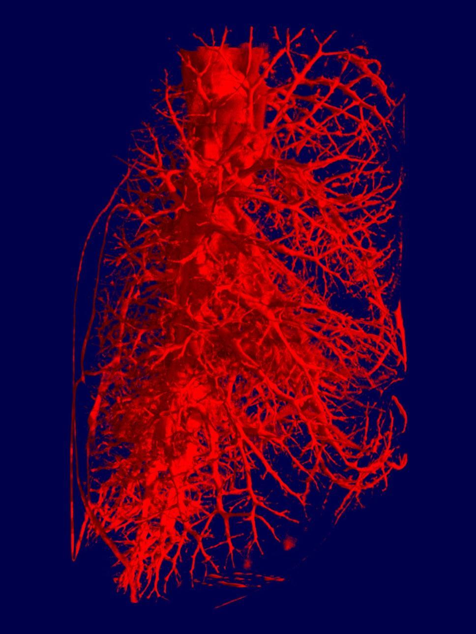 Tomography of a rat lung Schillinger (FRM II),