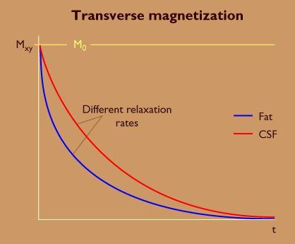 Dephasing Loss of transverse magnetization M xy T2 time refers to time interval for 37% loss of