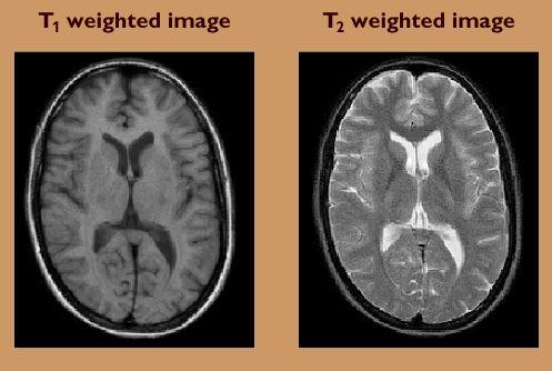 T1/T2 weighted images: 2011.10.04.