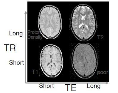 Contrast, Imaging Parameters: Short TEs reduce T2W Long TRs