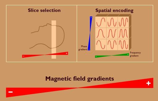 thinner slices The strength of your scanner s gradients can limit minimum slice thickness FDA limits speed of gradient shift (db/dt) and some of our