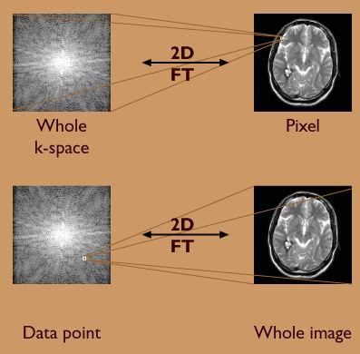 Raw MRI image: k-space (frequency domain) a k-space domain image is formed