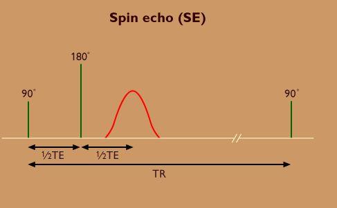 Primary types of Pulse sequences Spin Echo (SE): The most commonly used pulse sequence Uses 90 radio frequency pulses to excite the magnetization and one or more 180