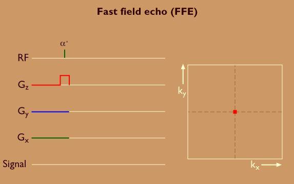Fast Spin Echo (FSE): Characterized by a series of rapidly applied 180 rephasing pulses and