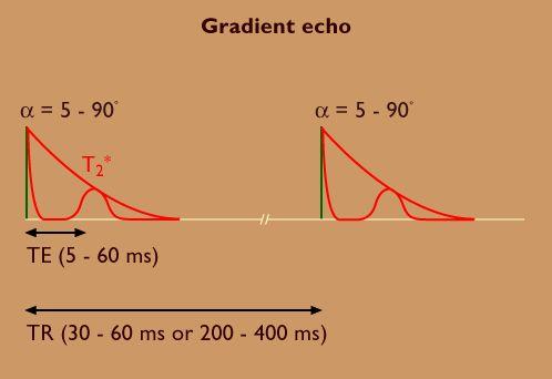 Gradient Echo (GRE): generated by using a pair of bipolar gradient pulses no refocusing 180 pulse and the data are sampled during a gradient echo, which is achieved by dephasing the spins with a