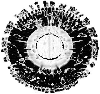 (b) Particles released from the posterior iris surface, View from iris surface.