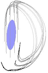 (c) Particle released from the center of the anterior chamber, Vertical orientation.