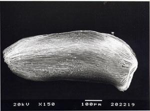 Barthlott (1981) stated that SEM of the seed-coat can be