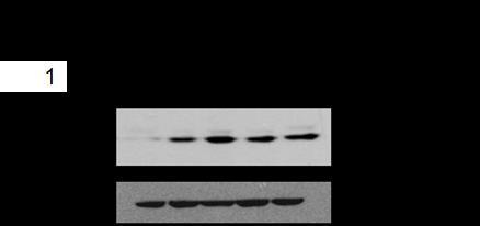 Then extracts the spleen tissue and analyzed the protein levels of p-i B, I B, and -Actin by western blot. Supplementary Figure 2.