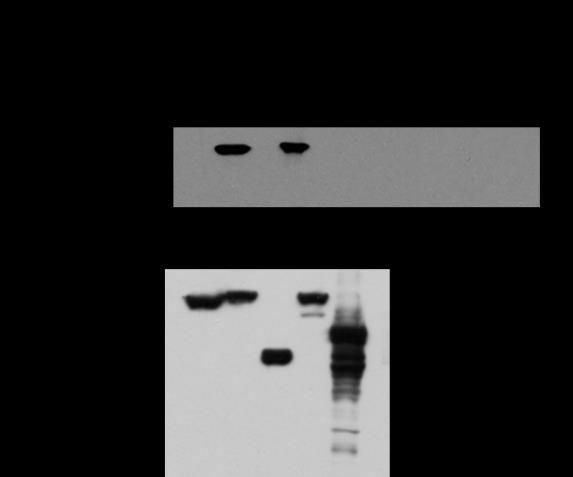 Cells were harvested and the total cell extracts were tested by western blot experiments for the occurrence of I B phosphorylation.