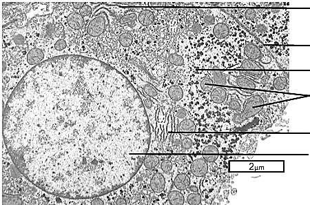 Identify the labeled structures in this liver cell TEM image.