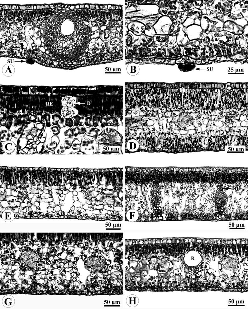 SRINUAL AND THAMMATHAWORN LEAF ANATOMY OF VATICA L. 127 FIGURE 2. Transverse sections of lamina. A and B. Subsessile glandular trichomes (V.diospyroides (A) and V. odorata (B)). C.