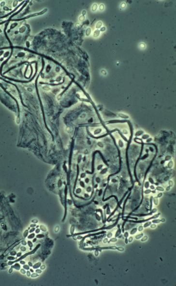 Yeasts Single celled fungi