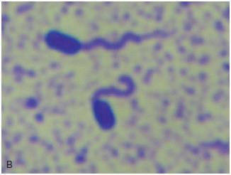24 Bacterial Flagella (Cont.