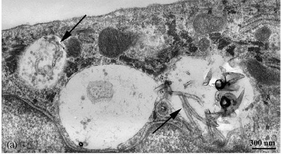 Toxicity of Carbon Nanotubes Induce apoptosis of human epidermal keratinocytes Shvedova et al.