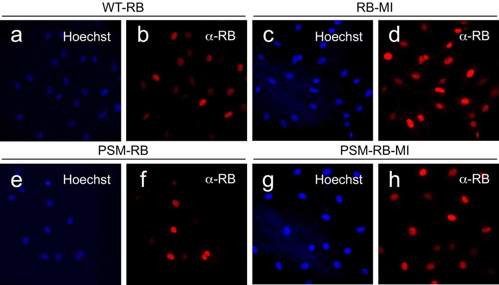 Results Figure 1. Induced expression and nuclear localization of RB variants in Rat-16 cells. The indicated cell lines were seeded on coverslips and cultured in the absence of tetracycline for 24 h.