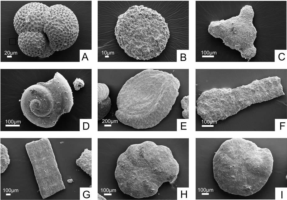 CORRELATION OF THE MIDDLE MIOCENE DEPOSITS 315 Fig. 4. Foraminifera of the Kosiv For ma tion (West Ukraine). A Globigerina bulloides d Orbigny, Kosiv Fm., Verbovets beds, Mosty 1 well, depth 1,413.