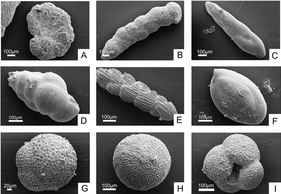 316 M. GARECKA & B. OLSZEWSKA Fig. 5. Foraminifera of the Kosiv For ma tion (West Ukraine). A Haplophragmoides laminatus Voloshinova, Kosiv Fm., Prut beds, Pyatnychany 1 well, depth 1,222.0 1,237.