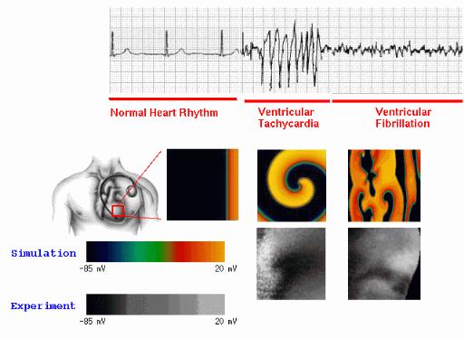 Chaotic chemical waves Electrochemical waves in cardiac cells cause the heart to contract.