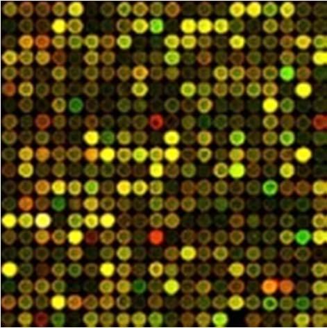 Gaussian Graphical Model Cell type Microarray samples