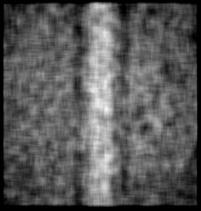 The source-bone distance is 30 cm, the bone detector distance is 150 cm. b) same image convoluted with the 13 m detector pixel size. 4.