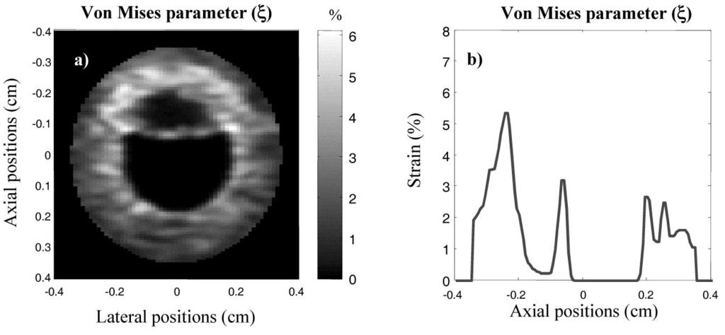 178 IEEE TRANSACTIONS ON MEDICAL IMAGING, VOL. 23, NO. 2, FEBRUARY 2004 Fig. 13. Comparison between simulated and theoretical VM parameters () for an heterogeneous vessel wall.