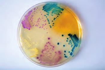 Clinical Microbiology Candida : CA222: 5 L pack CA223-25: 25 L pack Candida albicans Green Candida tropicalis Metallic blue Candida krusei Pink, fuzzy For isolation and differentiation of major