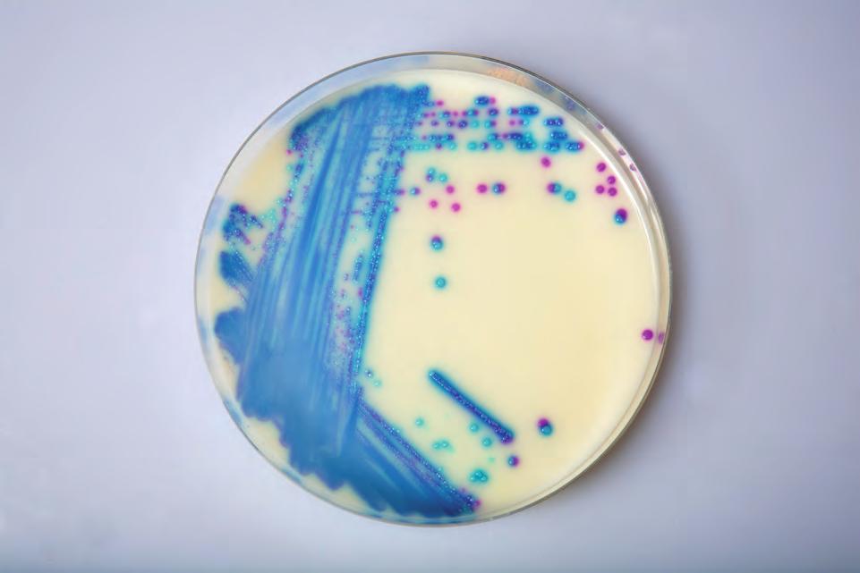 Failure to rapidly detect antibiotic resistant Gram negative bacteria has contributed to their uncontrolled spread, and sometimes to therapeutic failures.