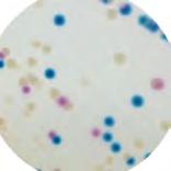 KPC ESBL C3G R Drug Resistant Bacteria Detection Clinical Microbiology KPRT2: 5 L pack KPRT3-25: 25 L pack For detection of carbapenem resistant bacteria* ESRT2: 5 L pack ESRT3-25: 25 L pack For