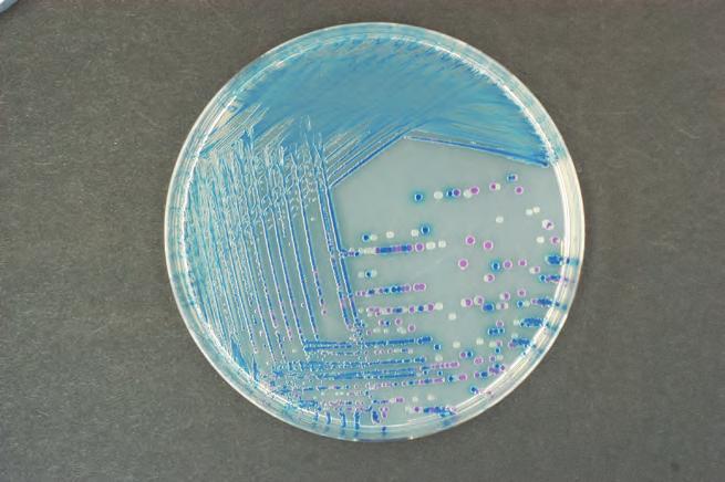 Since Rambach Agar has a very high specificity: (1) fewer samples are positive and have to be checked and (2) there is no more need to investigate 10 different suspect colonies per sample.